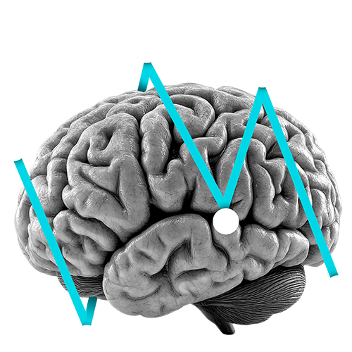 brain with line graph